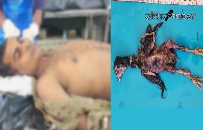 ब्रेकिंग अम्बिकापुर : जिंदा मुर्गा निगलने से हुई युवक की मौत..... क्या था कारण पढ़े पूरी खबर |