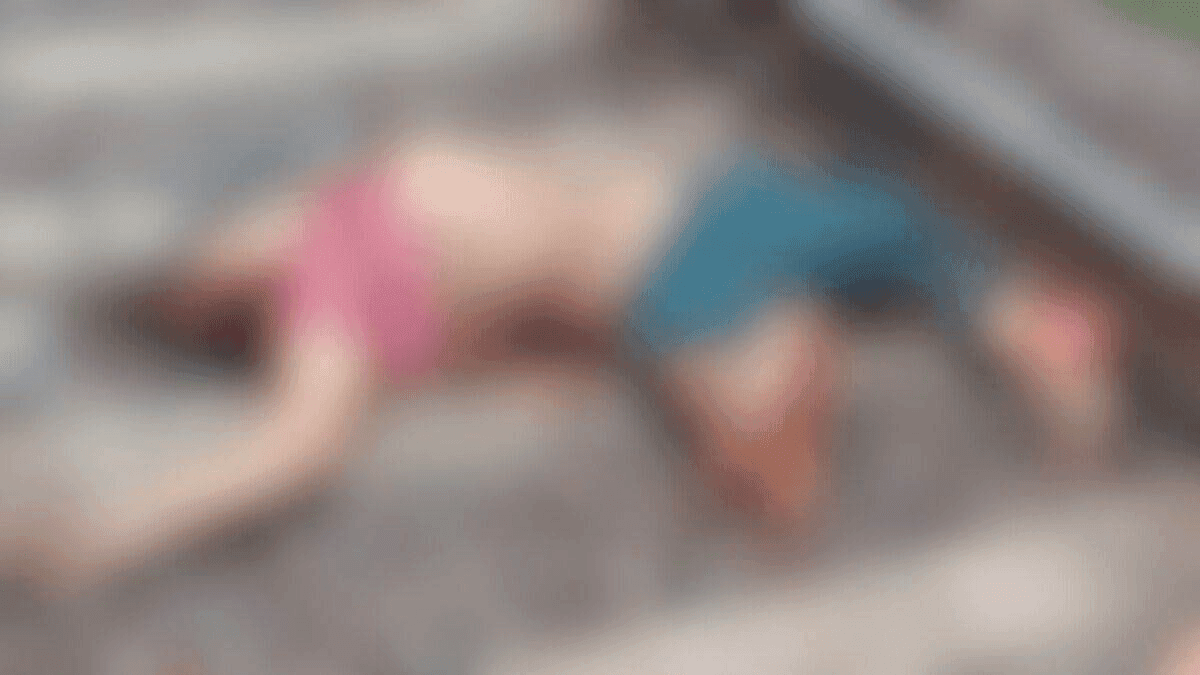जिला अस्पताल सूरजपुर में सफल ऑपरेशन कर मरीज के आंत में चिपका 1 किलोग्राम का ट्यूमर निकाला गया